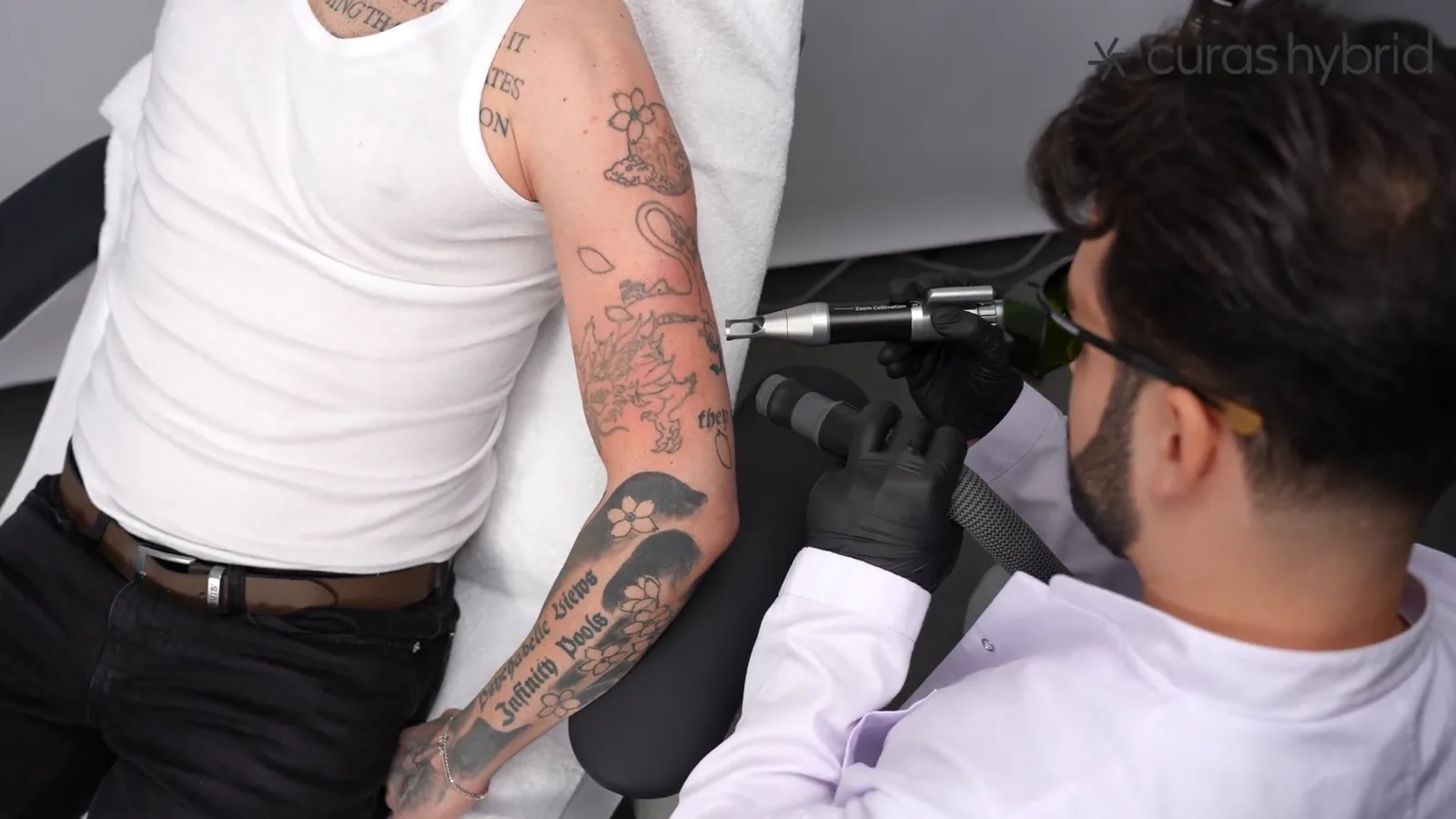Tattooentfernung in Heilbronn